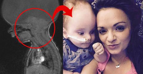 bayanlar bilir bu bebek beyni olmadan dogdu