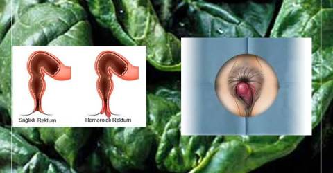 bayanlar bilir basura iyi gelen inanilmaz care