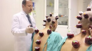 Peygamberimizin sünneti hacamat nelere iyi gelir