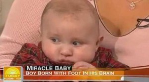 Bebeğin beyninde olan doktorları şok etti
