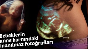 Bebeklerin anne karnındaki inanılmaz fotoğrafları