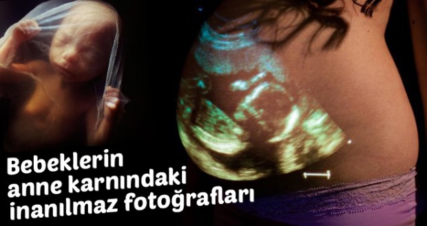 Bebeklerin anne karnındaki inanılmaz fotoğrafları