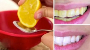 Limonla dişleri beyazlatmak
