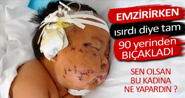 Çin’de bir hemşire (Malesef sağlık personeli) 8 aylık bebeği tarafından emzirirken memesini ısırdığı gerekçesiyle makas ile 90 yerinde kesikler attı. Haberin diğer fotoğrafları için görsele tıklayın