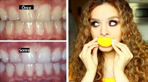 2 Dakikada dişleri beyazlatmak