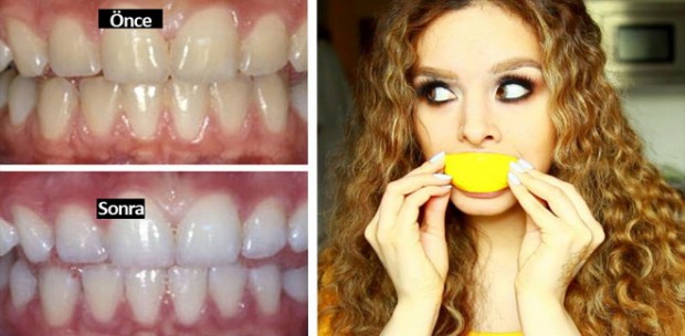 dişleri beyazlatmak