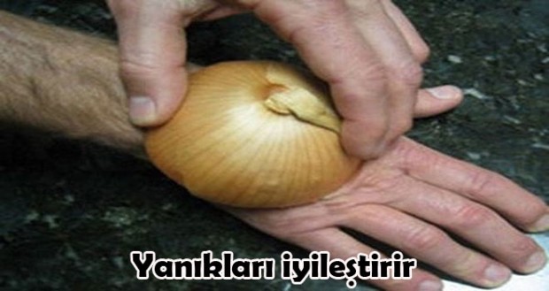 3- Soğan Yanıkları iyileştirir:Yemek yapanların her ne kadar dikkat ederse etsin malesef mutfak kazası yaşamaması mümkün değildir. Yanıklara karşı pratik ve etkili bir çözüm yarım soğanı yanıkların üzerine koymaktır. Eliniz yandığında soğanı ortadan ikiye kesin ve elinizin üzerine bastırın. Acısını kısa sürede dindirecektir.