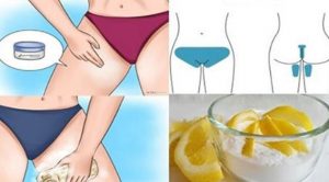 Bikini bölgesi kararmasına doğal çözüm