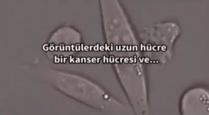 Kansere en etkili çözüm (Yüzde 90 etkisi kanıtlandı)