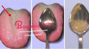 60 saniyede organlarınız sağlıklı mı öğrenme testi! Çay kaşığı testi