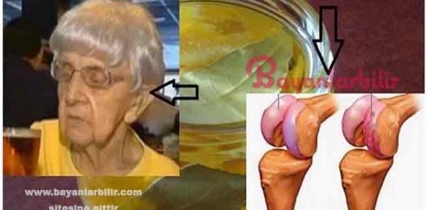 Eklem ağrılarını geçiren aspirin alkol iyot karışımı