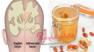 Fıstık ezmesi ile Alzheimer hastalığını erken teşhis etmek