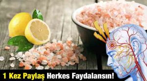 Migren Ağrısını Geçirmenin En Kolay Yolu