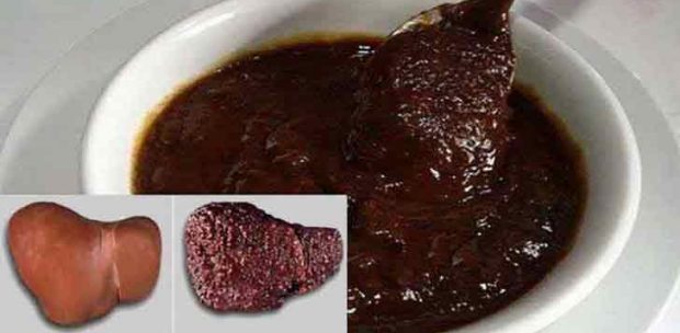 Karaciğeri gençleştiren tarif nasıl yapılır