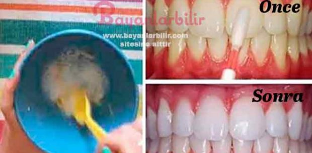 Limon karbonat ve muz kabuğu ile doğal diş beyazlatma yöntemi