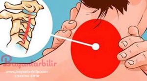 Boyun Ağrısına Bitkisel Tedavi