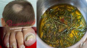 Sarımsak biberiye ile Mantar tedavisi nasıl yapılır