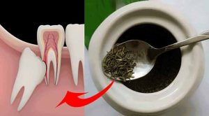 Çürüksüz ve Beyaz Dişler İçin En Doğal Formül